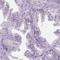 Autoimmunogenic cancer/testis antigen NY-ESO-2 antibody, HPA071467, Atlas Antibodies, Immunohistochemistry frozen image 
