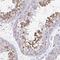 Adenosine Deaminase TRNA Specific 3 antibody, PA5-63626, Invitrogen Antibodies, Immunohistochemistry frozen image 