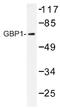 Interferon-induced guanylate-binding protein 1 antibody, AP01376PU-N, Origene, Western Blot image 