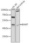 Betaine--homocysteine S-methyltransferase 1 antibody, GTX55537, GeneTex, Western Blot image 