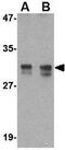 RASD Family Member 2 antibody, GTX85427, GeneTex, Western Blot image 