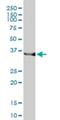 Heme Oxygenase 2 antibody, H00003163-M01, Novus Biologicals, Western Blot image 