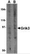 Glutamate Ionotropic Receptor Kainate Type Subunit 3 antibody, 4389, ProSci, Western Blot image 