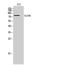 Glucosamine (UDP-N-Acetyl)-2-Epimerase/N-Acetylmannosamine Kinase antibody, A01647-1, Boster Biological Technology, Western Blot image 