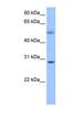 Elongator Acetyltransferase Complex Subunit 5 antibody, NBP1-57705, Novus Biologicals, Western Blot image 