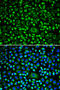 TAP Binding Protein antibody, 14-943, ProSci, Immunofluorescence image 