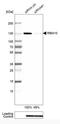 RNA Binding Motif Protein 10 antibody, NBP1-84951, Novus Biologicals, Western Blot image 