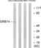 Growth Factor Receptor Bound Protein 14 antibody, LS-C120011, Lifespan Biosciences, Western Blot image 