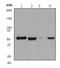 Aldehyde Dehydrogenase 7 Family Member A1 antibody, ab68192, Abcam, Western Blot image 