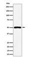 Purinergic Receptor P2Y12 antibody, M01136, Boster Biological Technology, Western Blot image 