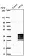 Nuclear Receptor Interacting Protein 3 antibody, NBP1-88544, Novus Biologicals, Western Blot image 