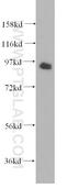 G Protein-Coupled Receptor Associated Sorting Protein 2 antibody, 12159-1-AP, Proteintech Group, Western Blot image 