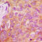 Insulin Receptor Substrate 1 antibody, GTX32201, GeneTex, Immunohistochemistry paraffin image 