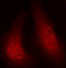 Ribosomal Protein S6 Kinase A1 antibody, LS-C335833, Lifespan Biosciences, Immunofluorescence image 