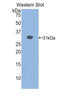 Histone Deacetylase 6 antibody, LS-C294531, Lifespan Biosciences, Western Blot image 