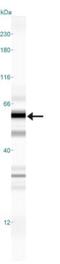 ATPase Cation Transporting 13A2 antibody, NB110-41486, Novus Biologicals, Western Blot image 