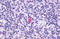 C-X-C Motif Chemokine Receptor 5 antibody, MBS243776, MyBioSource, Immunohistochemistry frozen image 