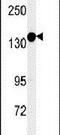 FANCD2 And FANCI Associated Nuclease 1 antibody, PA5-25171, Invitrogen Antibodies, Western Blot image 