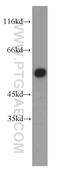 Drebrin Like antibody, 13015-1-AP, Proteintech Group, Western Blot image 