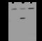 Hyaluronan Binding Protein 2 antibody, 200587-T34, Sino Biological, Western Blot image 