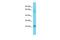 Transmembrane Protein 182 antibody, GTX14704, GeneTex, Western Blot image 