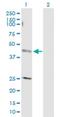 MUARP2 antibody, H00009179-D01P, Novus Biologicals, Western Blot image 