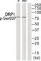 Dynamin 1 Like antibody, 79-951, ProSci, Western Blot image 