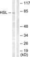 Lipase E, Hormone Sensitive Type antibody, LS-C199083, Lifespan Biosciences, Western Blot image 