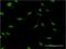 Cleavage Stimulation Factor Subunit 2 antibody, H00001478-M02, Novus Biologicals, Immunocytochemistry image 