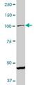 PPARG Coactivator 1 Alpha antibody, ab77210, Abcam, Western Blot image 