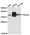 Regulator Of G Protein Signaling 2 antibody, STJ113405, St John