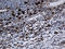 Cathepsin L antibody, LS-C796468, Lifespan Biosciences, Immunohistochemistry paraffin image 