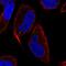 Microtubule Associated Protein 1 Light Chain 3 Gamma antibody, NBP2-57604, Novus Biologicals, Immunofluorescence image 