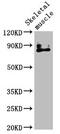 Transient Receptor Potential Cation Channel Subfamily V Member 2 antibody, CSB-PA897571LA01HU, Cusabio, Western Blot image 