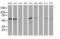 Katanin Catalytic Subunit A1 Like 1 antibody, MA5-25399, Invitrogen Antibodies, Western Blot image 