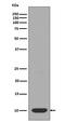 Dynein Light Chain LC8-Type 1 antibody, M03454, Boster Biological Technology, Western Blot image 