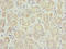 TPD52 Like 1 antibody, LS-C676625, Lifespan Biosciences, Immunohistochemistry paraffin image 