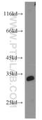 Sperm Associated Antigen 7 antibody, 16294-1-AP, Proteintech Group, Western Blot image 