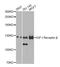 Insulin Like Growth Factor 1 Receptor antibody, A0243, ABclonal Technology, Western Blot image 
