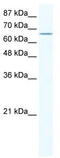 Calcium Voltage-Gated Channel Auxiliary Subunit Beta 2 antibody, TA341723, Origene, Western Blot image 