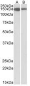 MCF.2 Cell Line Derived Transforming Sequence Like antibody, AP32803PU-N, Origene, Western Blot image 