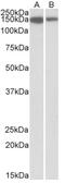 MCF.2 Cell Line Derived Transforming Sequence Like antibody, AP32803PU-N, Origene, Western Blot image 