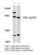 P100 antibody, LS-C177342, Lifespan Biosciences, Western Blot image 