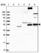 Feline Leukemia Virus Subgroup C Cellular Receptor Family Member 2 antibody, PA5-58195, Invitrogen Antibodies, Western Blot image 