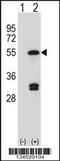 Farnesyl-Diphosphate Farnesyltransferase 1 antibody, 57-820, ProSci, Western Blot image 