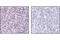 Spi-1 Proto-Oncogene antibody, 2258S, Cell Signaling Technology, Immunohistochemistry paraffin image 