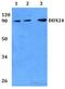 DEAD-Box Helicase 24 antibody, A10710-1, Boster Biological Technology, Western Blot image 