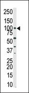 Protein Kinase N3 antibody, LS-C99726, Lifespan Biosciences, Western Blot image 