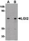 Leucine Rich Repeat LGI Family Member 2 antibody, PA5-20492, Invitrogen Antibodies, Western Blot image 