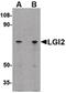 Leucine-rich repeat LGI family member 2 antibody, PA5-20492, Invitrogen Antibodies, Western Blot image 